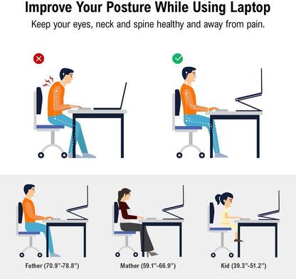 💥💻 Laptop állvány alumíniumötvözetből készült forgatható állvány